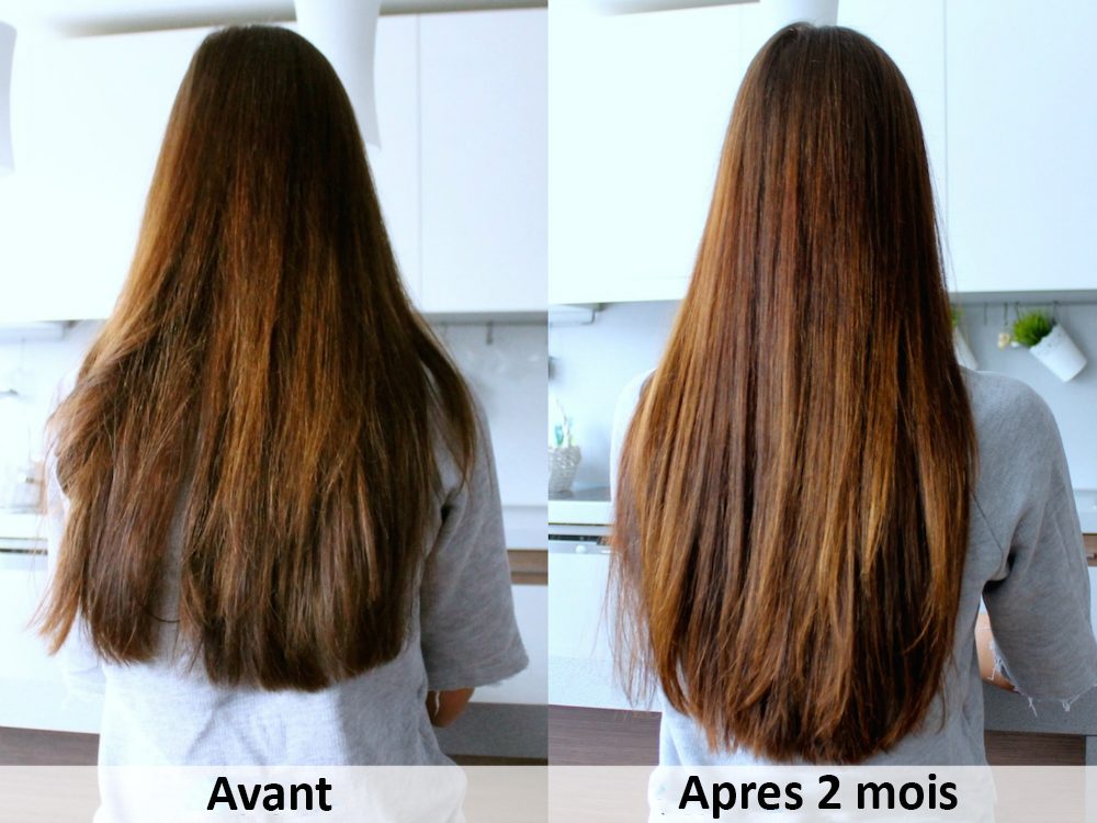 Les masques pour laccélération de la croissance des cheveu avec les vitamines et et e